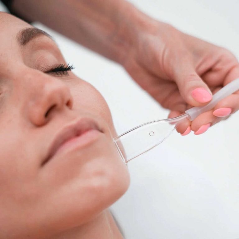 Masaż próżniowy twarzy wykonywany za pomocą specjalnej końcówki – zabieg poprawiający jędrność i krążenie w gabinecie Holistic Beauty.