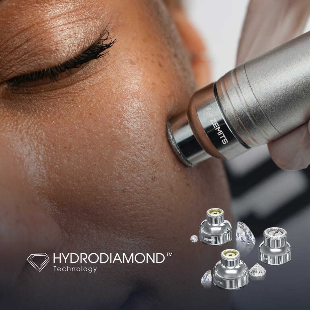 Technologia HydroDiamond podczas zabiegu oczyszczania skóry twarzy.